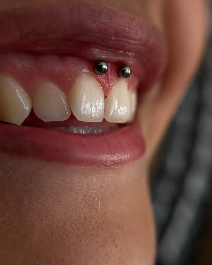 Smiley